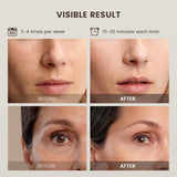 Mascarilla Facial LED · 7 Colores — Rostro Y Cuello